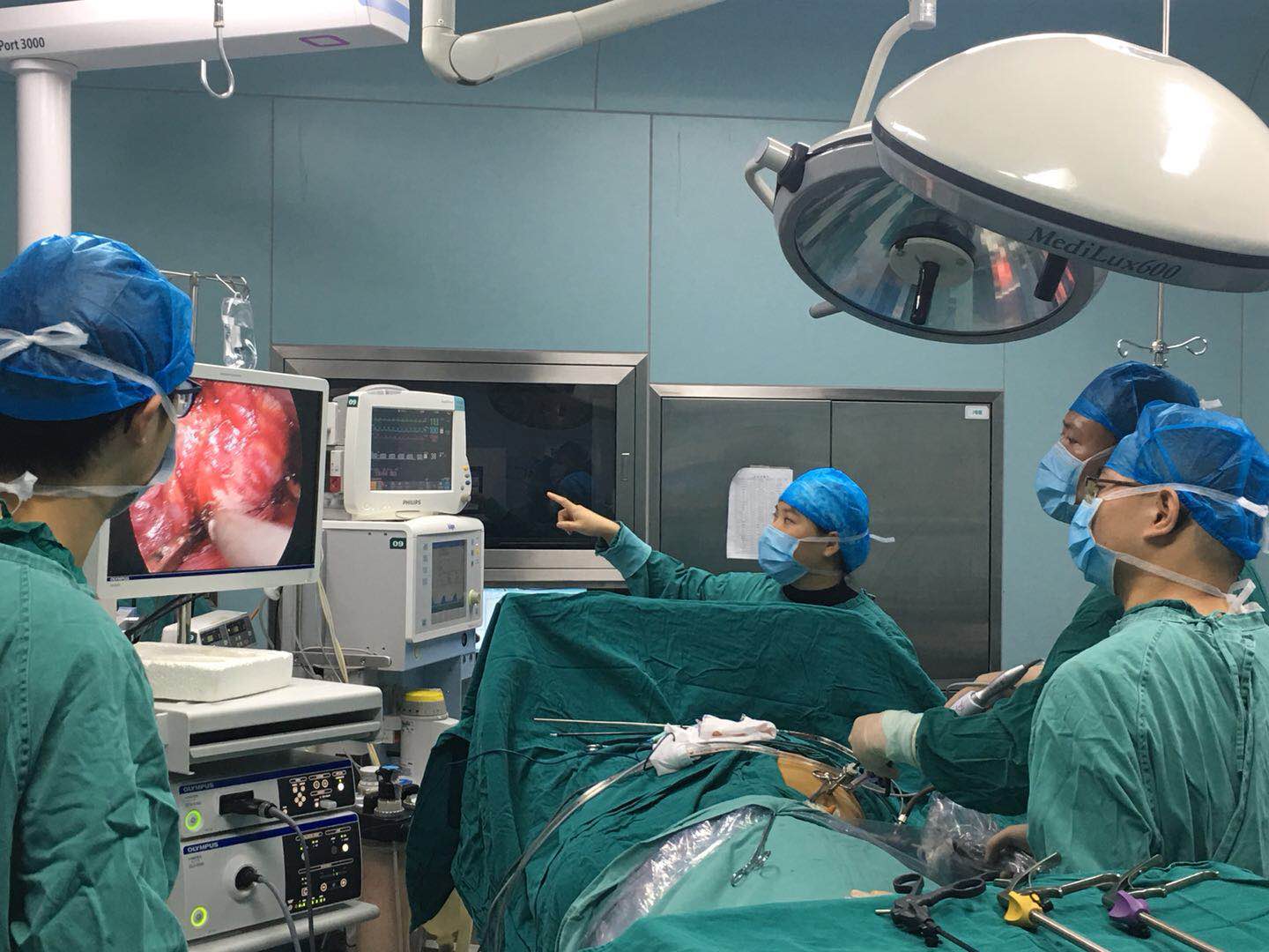 再挑手术禁区：我院泌尿外科成功实施腹腔镜下巨大肾上腺嗜铬细胞瘤切除术