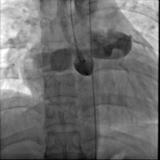 张嘉淋术前.jpg 张嘉淋术前.jpg