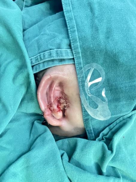 97FB8013-B4E7-4947-801A-C34FAF1E047D.jpeg 97FB8013-B4E7-4947-801A-C34FAF1E047D.jpeg