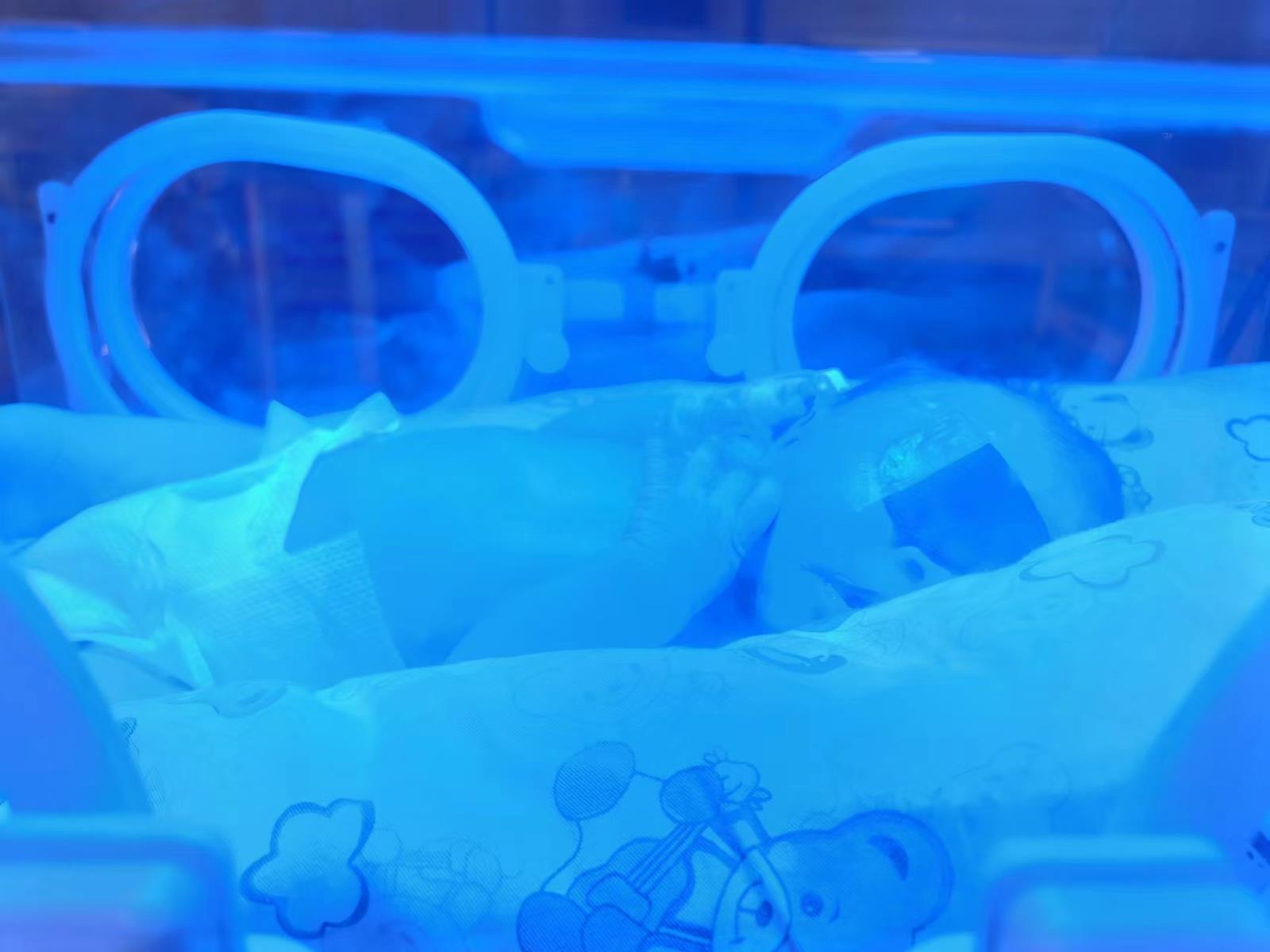 新手爸妈如何应对新生儿黄疸呢？