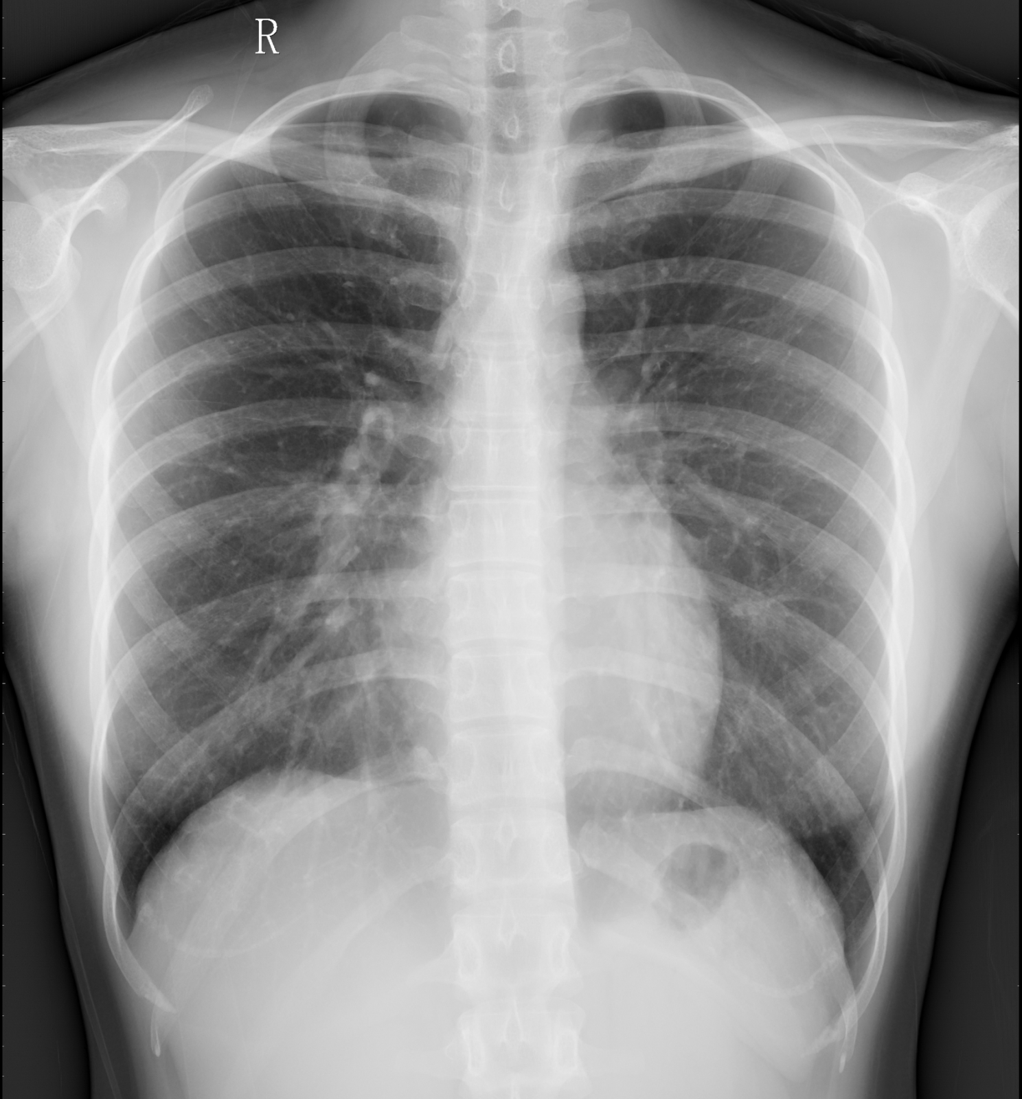 图片2.png 图片2.png