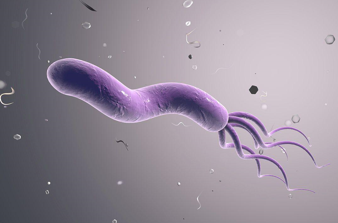 检查出螺杆菌感染，必须要治吗？不治会不会发展成胃癌?